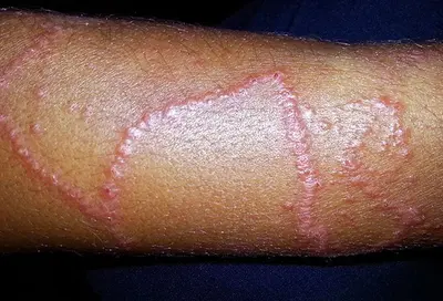 PORTUGALI SÕJALAEV | OHTLIKUD MEDUUSID